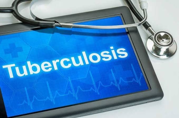 Kangra Districts Leads Himachal Pradesh In TB Prevention With 91 Percent Coverage
