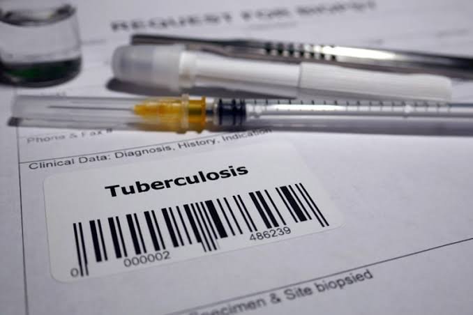 Kangra To Conduct Comprehensive Study On Tuberculosis Burden And Disease Hotspots