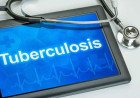 Kangra Districts Leads Himachal Pradesh In TB Prevention With 91 Percent Coverage