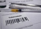 Kangra To Conduct Comprehensive Study On Tuberculosis Burden And Disease Hotspots