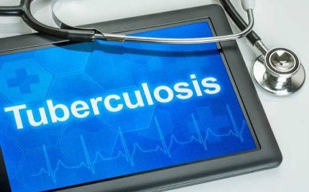 Kangra Districts Leads Himachal Pradesh In TB Prevention With 91 Percent Coverage