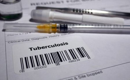 Kangra To Conduct Comprehensive Study On Tuberculosis Burden And Disease Hotspots