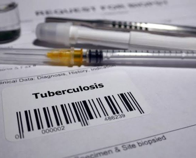 Kangra To Conduct Comprehensive Study On Tuberculosis Burden And Disease Hotspots